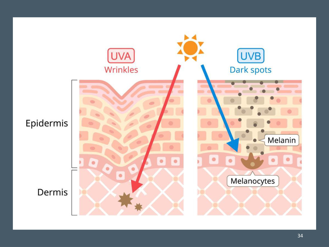 UVA ทะลุถึงหนังแท้ทำให้เกิดริ้วรอย, UVB กระตุ้นเมลาโนไซต์เกิดจุดด่างดำ